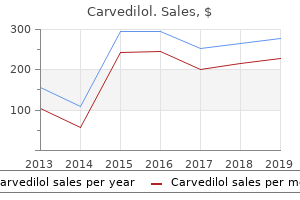 buy carvedilol on line amex