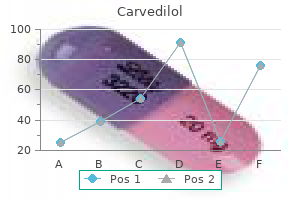 buy carvedilol 12.5 mg without a prescription