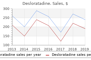 buy desloratadine 5 mg on line